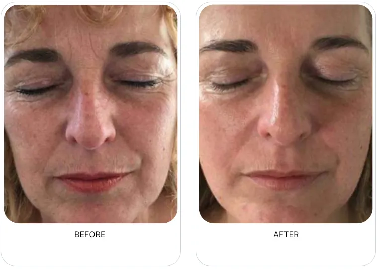 CaVaBien Spa & Salon | Oxygeneo 3-in-1 Calgary