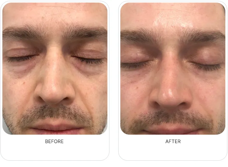 CaVaBien Spa & Salon | Oxygeneo 3-in-1 Calgary