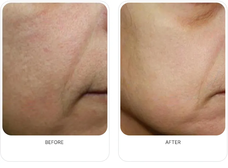 CaVaBien Spa & Salon | Oxygeneo 3-in-1 Calgary