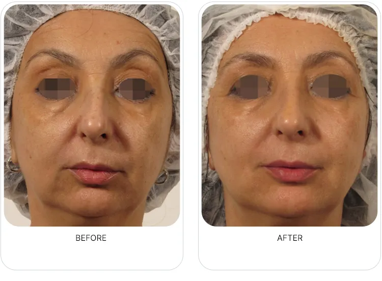 CaVaBien Spa & Salon | Oxygeneo 3-in-1 Calgary